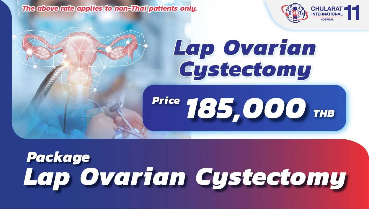 Lap Ovarian Cystectomy