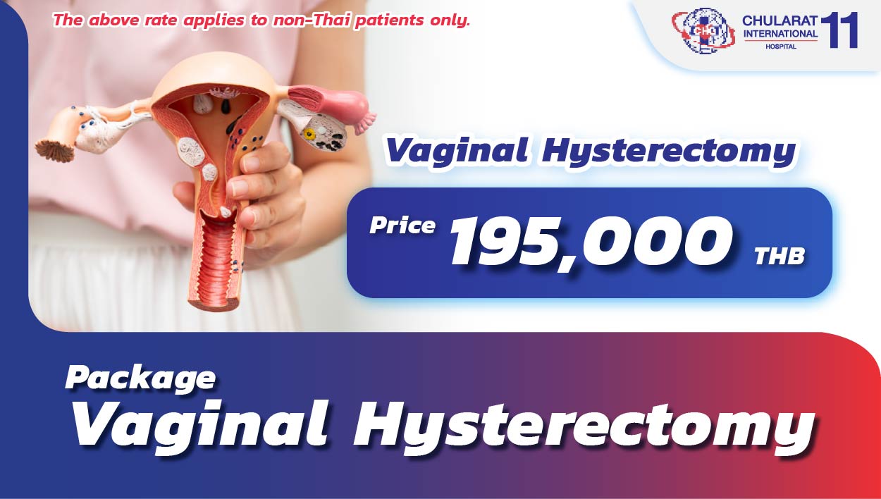 Vaginal Hysterectomy