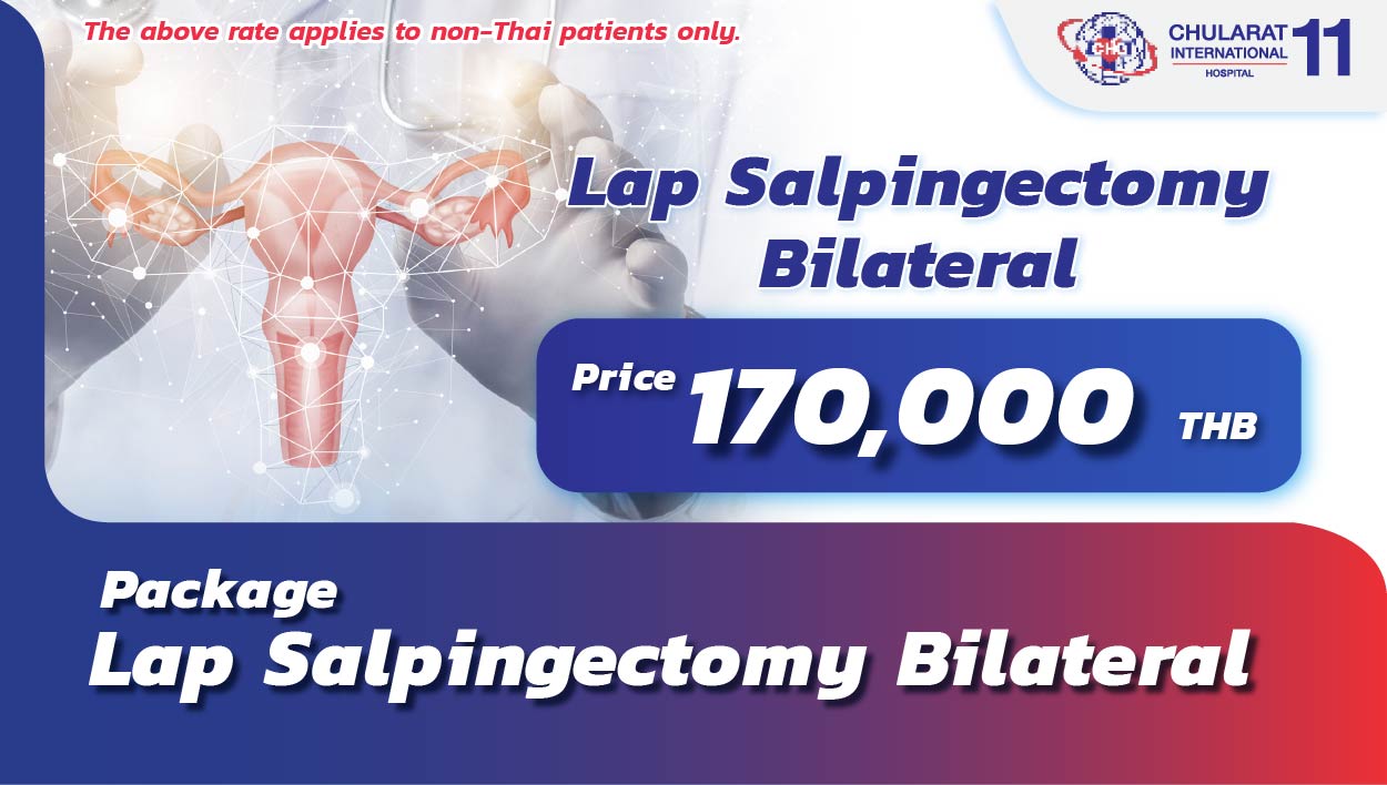 Lap Salpingectomy Bilateral