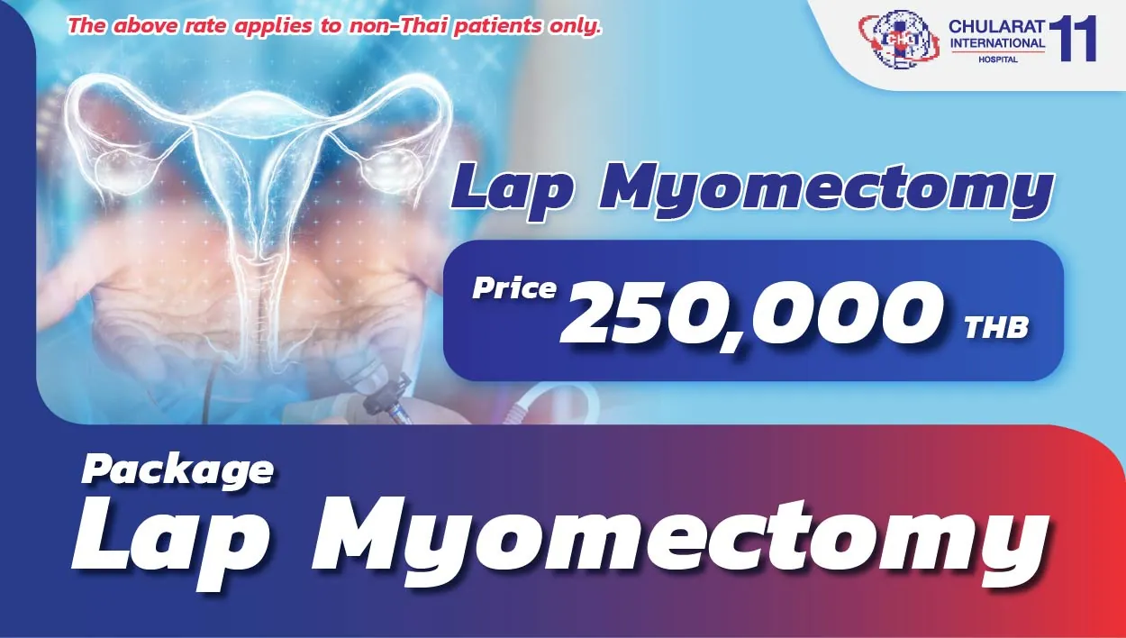 Lap Myomectomy