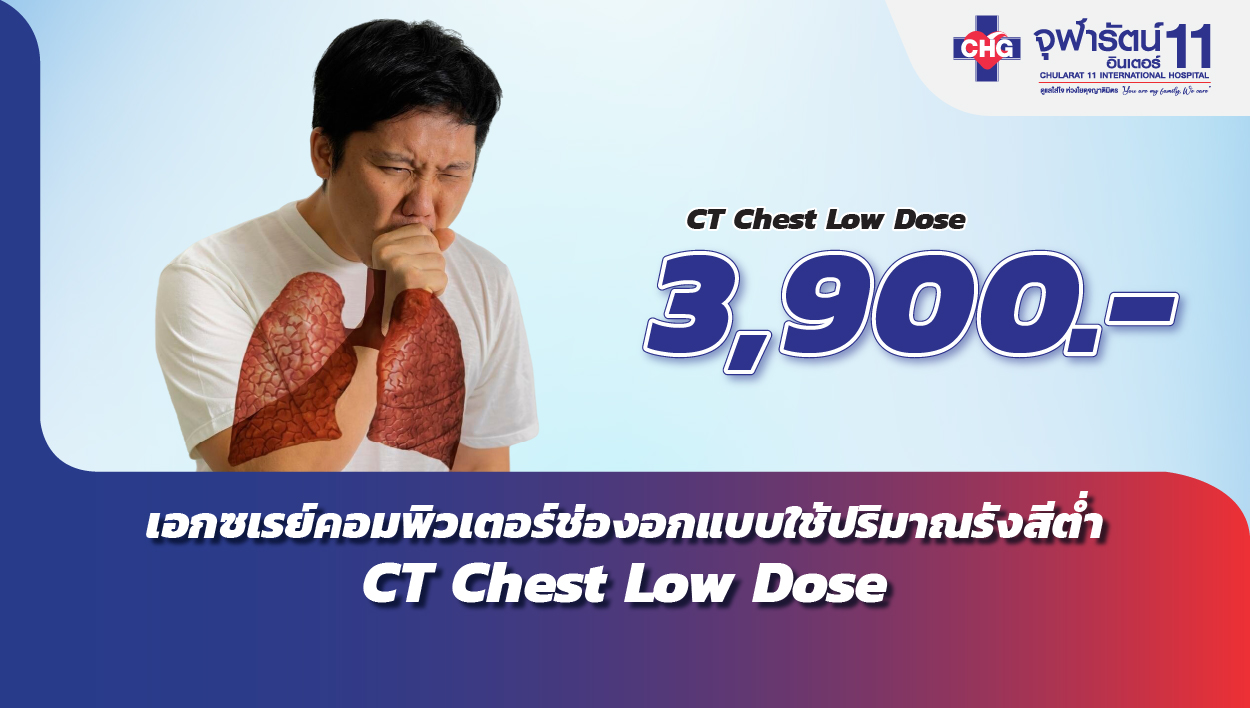 เอกซเรย์คอมพิวเตอร์ช่องอกแบบใช้ปริมาณรังสีต่ำ