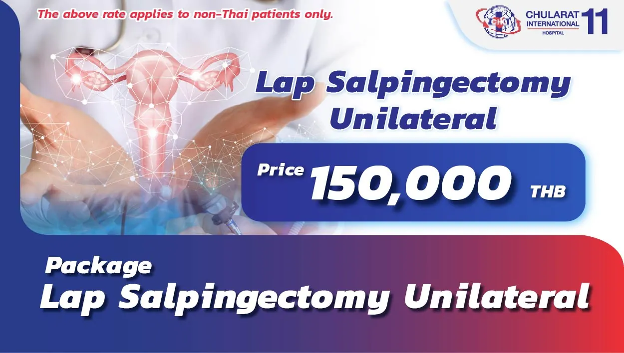 Lap Salpingectomy Unilateral